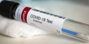 A test tube containing a blood sample for COVID-19 testing